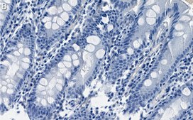 Anti-E2F-1 Antibody, clone 1H21 ZooMAb® Rabbit Monoclonal recombinant, expressed in HEK 293 cells