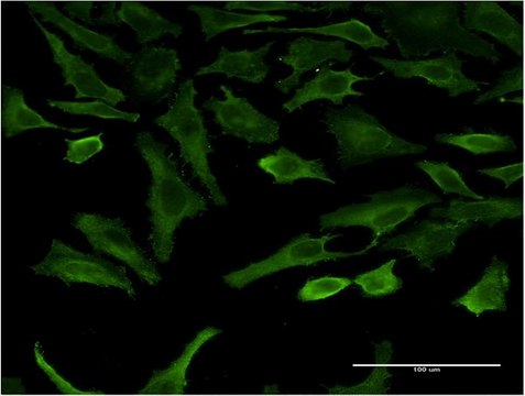 Monoclonal Anti-SGK2 antibody produced in mouse clone 2F6, purified immunoglobulin, buffered aqueous solution