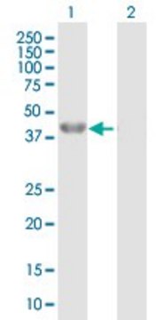 Anti-BHMT antibody produced in mouse purified immunoglobulin, buffered aqueous solution