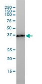 Monoclonal Anti-TMEM115 antibody produced in mouse clone 3D4, purified immunoglobulin, buffered aqueous solution
