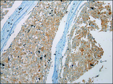 Anti-NUDT6 affinity isolated antibody