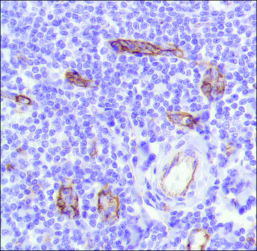 Anti-CD31 antibody, Rabbit monoclonal clone SP164, recombinant, expressed in proprietary host, affinity isolated antibody