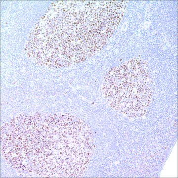 BCL6 (GI191E/A8) Mouse Monoclonal Antibody