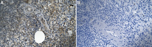 Anti-CCR4/CD194 Antibody, clone 1N13 ZooMAb&#174; Rabbit Monoclonal recombinant, expressed in HEK 293 cells