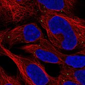 Anti-CCDC130 antibody produced in rabbit Prestige Antibodies® Powered by Atlas Antibodies, affinity isolated antibody, buffered aqueous glycerol solution