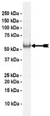 Parkin (c-Myc tagged) Protein, active, 10 µg Active, full length, recombinant human Parkin. N-terminal c-Myc, 6His-tagged. For use in Enzyme Assays. Functions as an E3 ligase in ubiquitination assays.