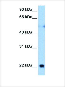 Anti-RTN4 (AB2) antibody produced in rabbit affinity isolated antibody