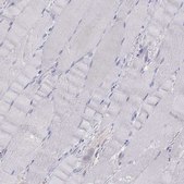 Anti-MUC16 Prestige Antibodies® Powered by Atlas Antibodies, affinity isolated antibody