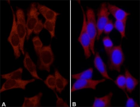 Anti-NQO1 (C-terminal) antibody produced in rabbit ~1&#160;mg/mL, affinity isolated antibody, buffered aqueous solution