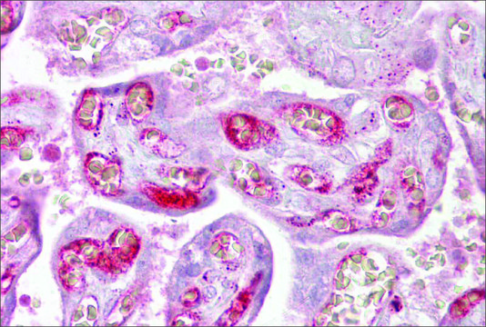 Anti-PPP2R3A, (N-terminal) antibody produced in rabbit affinity isolated antibody