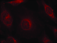 Anti-phospho-AKT1/AKT2/AKT3 (pTyr315/pTyr316/pTyr312) antibody produced in rabbit affinity isolated antibody