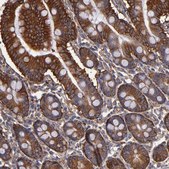 Anti-MVP antibody produced in rabbit affinity isolated antibody, buffered aqueous glycerol solution