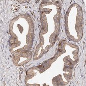 Anti-CAP1 antibody produced in rabbit Prestige Antibodies® Powered by Atlas Antibodies, affinity isolated antibody, buffered aqueous glycerol solution
