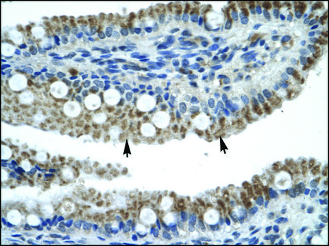 Anti-ZNF683 antibody produced in rabbit IgG fraction of antiserum