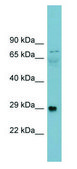 Anti-DAG1 antibody produced in rabbit affinity isolated antibody