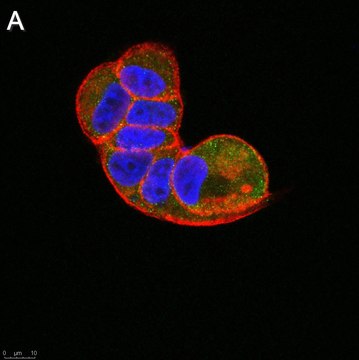 Anti-TSG101 Antibody, clone 2H18 ZooMAb&#174; Rabbit Monoclonal recombinant, expressed in HEK 293 cells