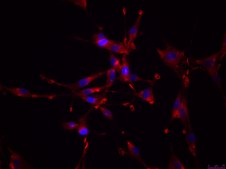 OSUMMER.12 Mouse NRAS-Mutant Melanoma Cell Line