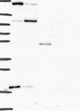 Anti-CTSA antibody produced in rabbit Prestige Antibodies&#174; Powered by Atlas Antibodies, affinity isolated antibody, buffered aqueous glycerol solution