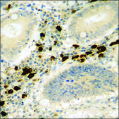 Anti-phospho-p62 Dok (pTyr398) antibody produced in rabbit affinity isolated antibody