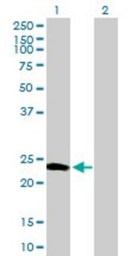 Anti-CALN1 antibody produced in mouse purified immunoglobulin, buffered aqueous solution