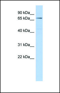 Anti-CLPB antibody produced in rabbit affinity isolated antibody