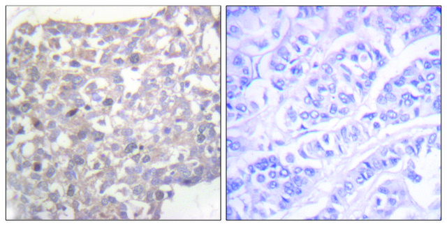 Anti-Tubulin &#947;, C-Terminal antibody produced in rabbit affinity isolated antibody