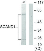 Anti-SCAND1 antibody produced in rabbit affinity isolated antibody