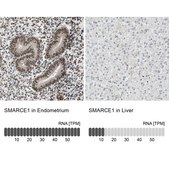 Anti-SMARCE1 antibody produced in rabbit Prestige Antibodies® Powered by Atlas Antibodies, affinity isolated antibody, buffered aqueous glycerol solution