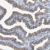 Anti-SEC23B antibody produced in rabbit Prestige Antibodies® Powered by Atlas Antibodies, affinity isolated antibody, buffered aqueous glycerol solution