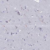 Anti-TRIM46 Prestige Antibodies® Powered by Atlas Antibodies, affinity isolated antibody