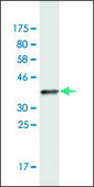 Monoclonal Anti-MOCS2 antibody produced in mouse clone 4H3, purified immunoglobulin, buffered aqueous solution