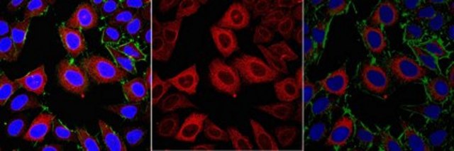 Anti-TACC3 Antibody from rabbit, purified by affinity chromatography