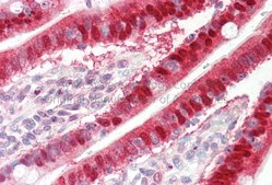 Anti-SULT1A1 antibody produced in rabbit affinity isolated antibody