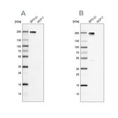 Anti-NID2 antibody produced in rabbit Prestige Antibodies® Powered by Atlas Antibodies, affinity isolated antibody, buffered aqueous glycerol solution