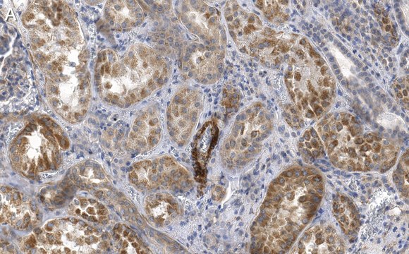 Anti-Endoglin Antibody, clone 1I15 ZooMAb&#174; Rabbit Monoclonal recombinant, expressed in HEK 293 cells