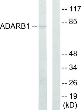 Anti-ADARB1 antibody produced in rabbit affinity isolated antibody