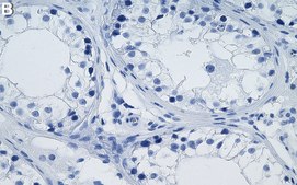 Anti-MGEA5/OGA Antibody, clone 1B3 ZooMAb® Rabbit Monoclonal recombinant, expressed in HEK 293 cells