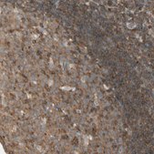 Anti-OXSR1 antibody produced in rabbit Prestige Antibodies® Powered by Atlas Antibodies, affinity isolated antibody, buffered aqueous glycerol solution