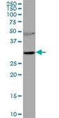 Anti-RNASEH2A antibody produced in mouse purified immunoglobulin, buffered aqueous solution