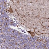 Anti-GAD1 antibody produced in rabbit Prestige Antibodies® Powered by Atlas Antibodies, affinity isolated antibody, buffered aqueous glycerol solution