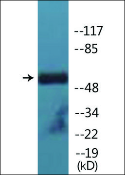 Anti-phospho-Lck (pTyr505) antibody produced in rabbit affinity isolated antibody