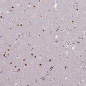 Anti-WDR18 antibody produced in rabbit Prestige Antibodies® Powered by Atlas Antibodies, affinity isolated antibody, buffered aqueous glycerol solution