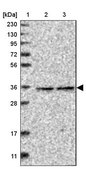 Anti-RABGGTB antibody produced in rabbit Prestige Antibodies® Powered by Atlas Antibodies, affinity isolated antibody, buffered aqueous glycerol solution, Ab1