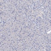 Anti-OSBPL6 antibody produced in rabbit Prestige Antibodies® Powered by Atlas Antibodies, affinity isolated antibody, buffered aqueous glycerol solution