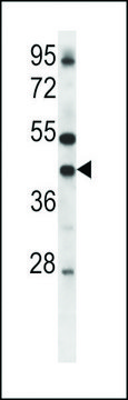 ANTI-CONNEXIN 37(C-TERMINAL) antibody produced in rabbit IgG fraction of antiserum, buffered aqueous solution