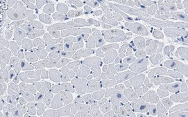 Anti-Ryanodine Receptor 2 Antibody, clone 2K6 ZooMAb® Rabbit Monoclonal recombinant, expressed in HEK 293 cells