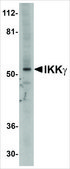 Anti-IKKγ antibody produced in rabbit affinity isolated antibody, buffered aqueous solution