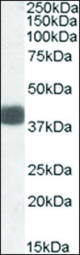 Anti-FBXO32 antibody produced in goat affinity isolated antibody, buffered aqueous solution