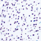 Anti-Hydroxyl-Histone H2A-Y39 antibody produced in rabbit