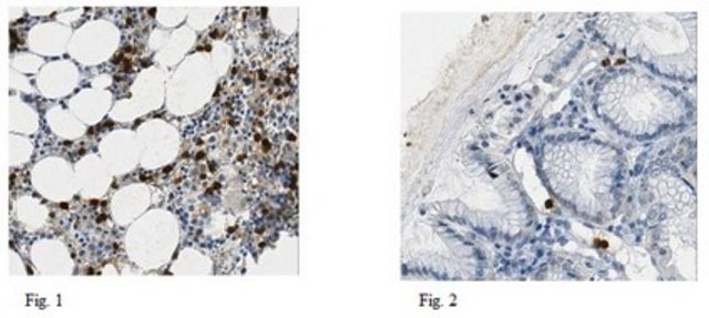 Anti-Lipocalin-2 Antibody, clone PA348-26.3.5 clone PA348-26.3.5, from mouse